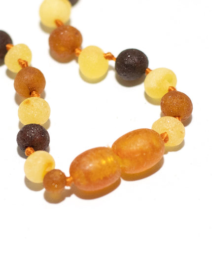 Baby/Kind – Bernsteinkette – runde Zitronenperlen – 33 cm