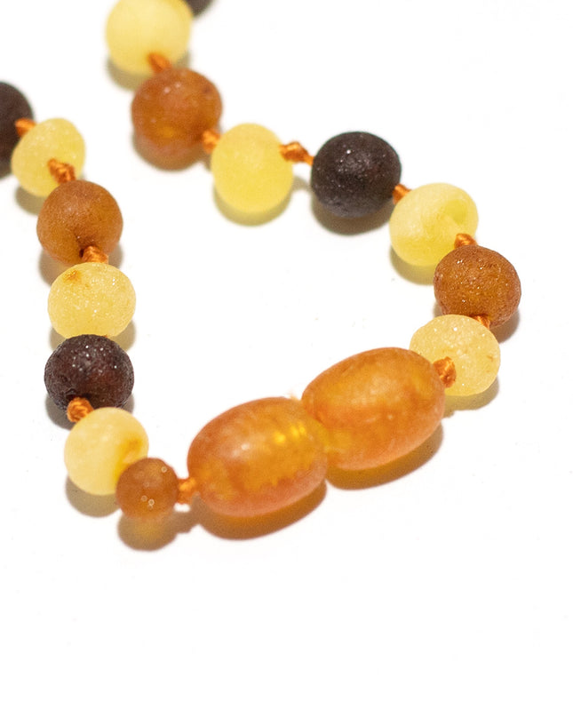Baby/Kind – Bernsteinkette – runde Zitronenperlen – 33 cm